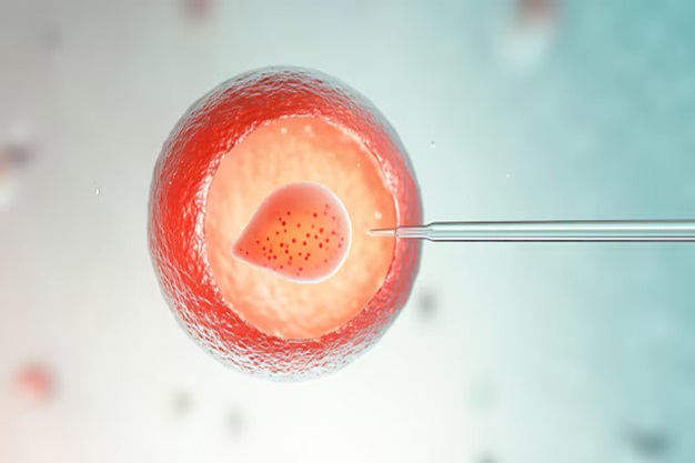 IVF (Test Tube Baby)